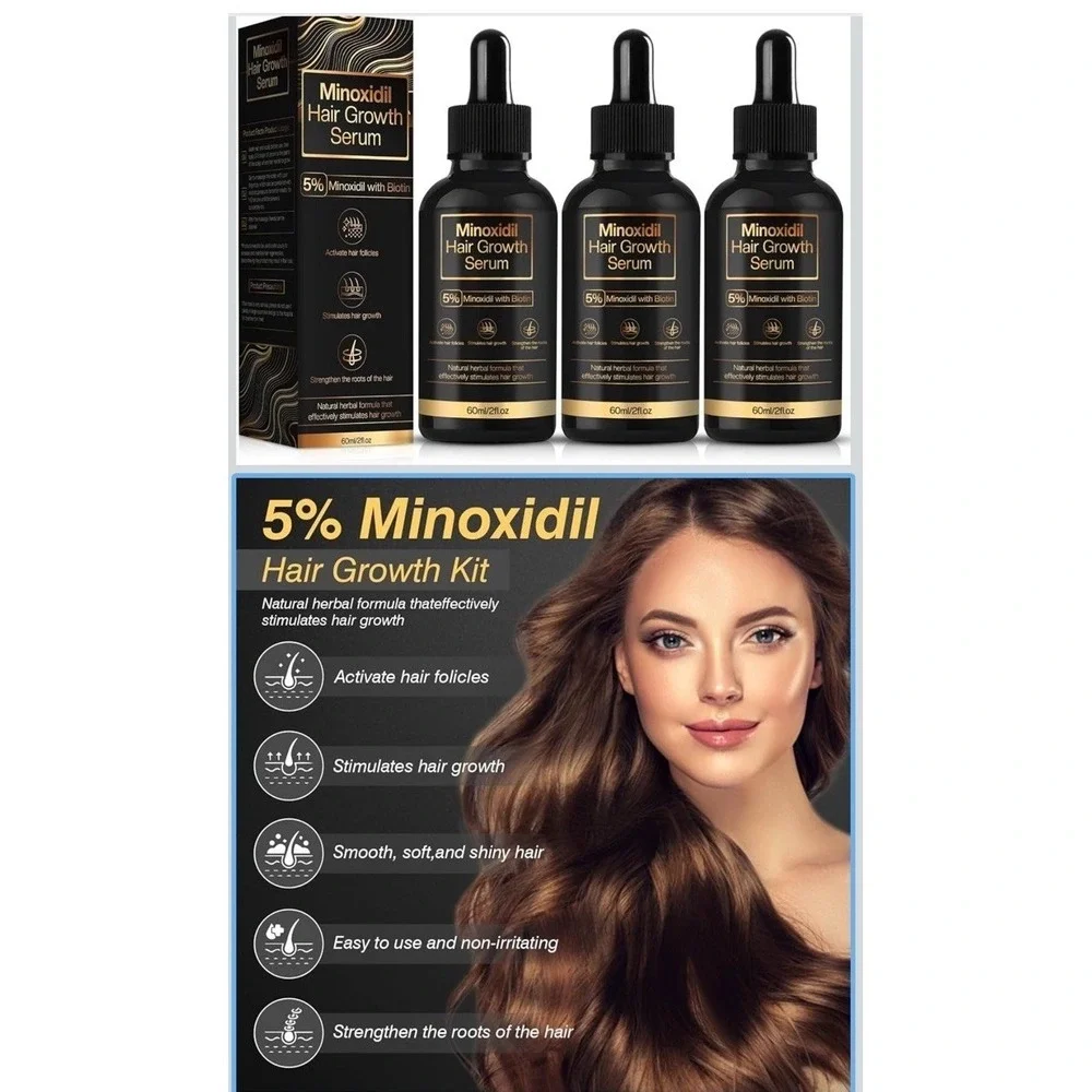 5% Minoxidil Hair Growth Serum Men And Women, Promotes Hair Growth, 3 Bottles!